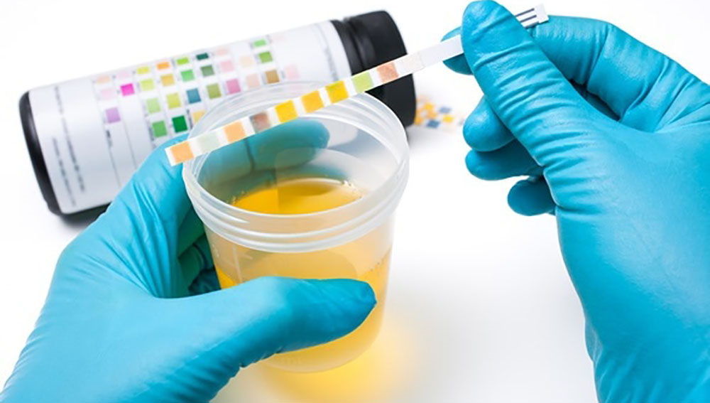 Can labs detect quick fix synthetic urine